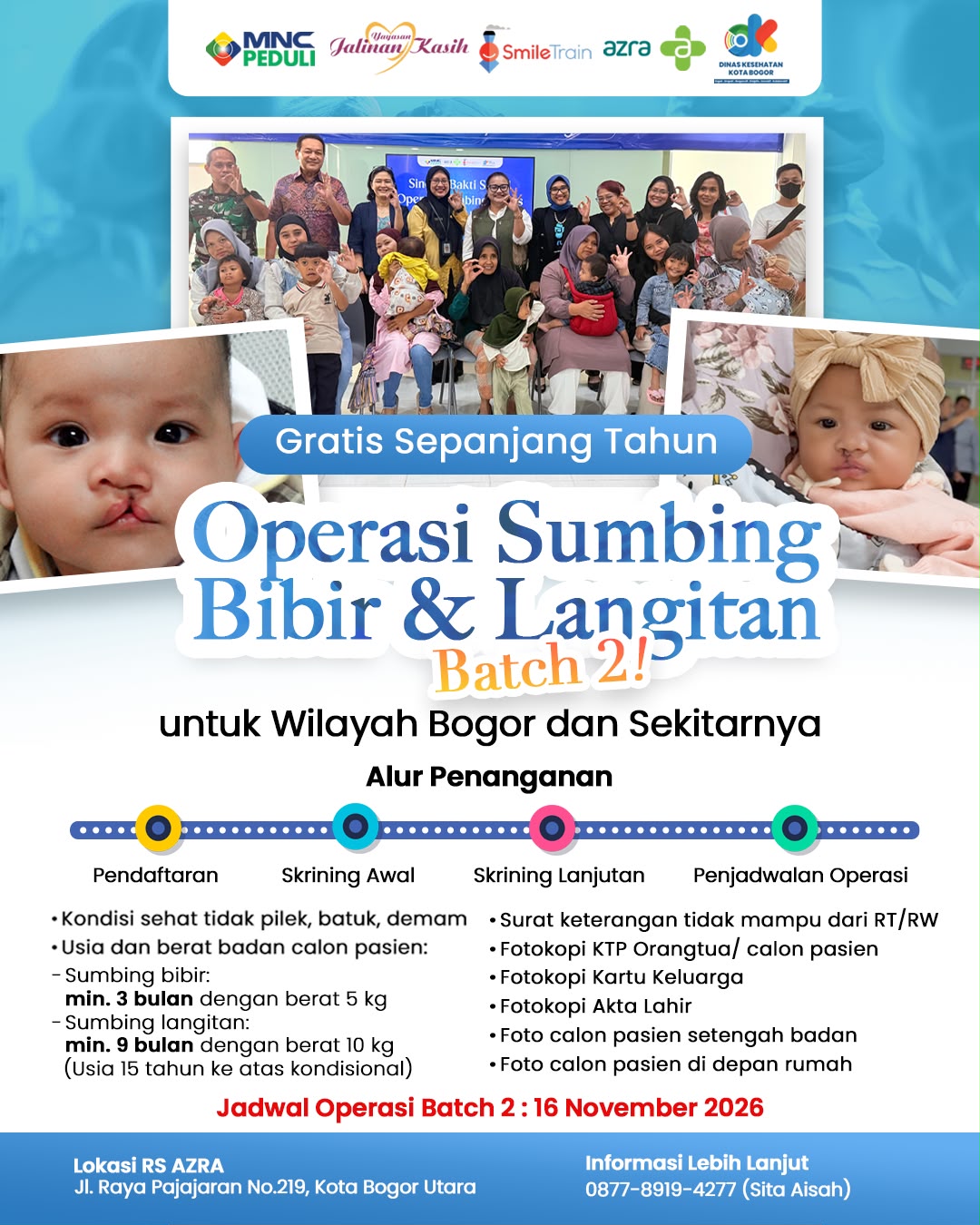 operasi bibir sumbing gratis